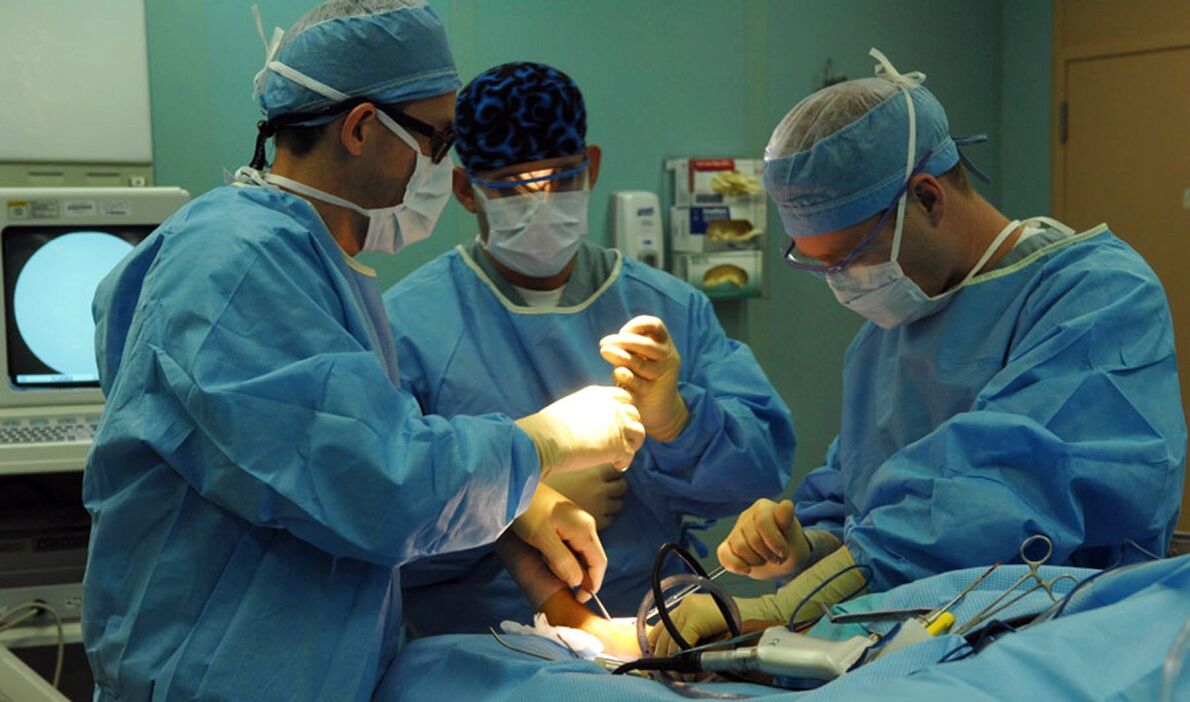 静脈瘤の外科的治療