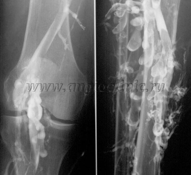 超音波スキャン